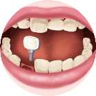 清洁牙齿解压游戏